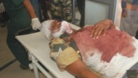 Feriti - Guwahati - 30-07-2010 - Attentato in India, i separatisti uccidono cinque paramilitari