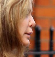 Tara Palmer-Tomkinson - Londra - 12-04-2011 - L'ex di Robbie Williams sfigurata dalla cocaina: il naso crolla prima delle nozze reali