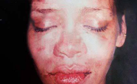 Rihanna - Los Angeles - 03-04-2014 - Violenza sulle donne: le celebrity non sono escluse