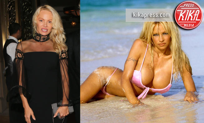 Pamela Anderson - Los Angeles - 07-01-2017 - Pamela Anderson, cos'è successo alla tua faccia?